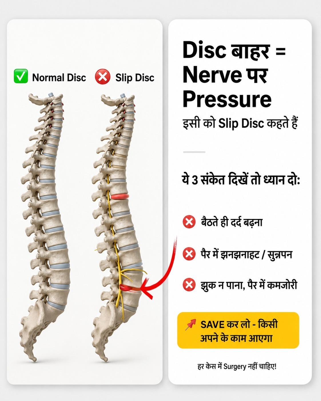 Experiencing discomfort and limited mobility due to a slip d