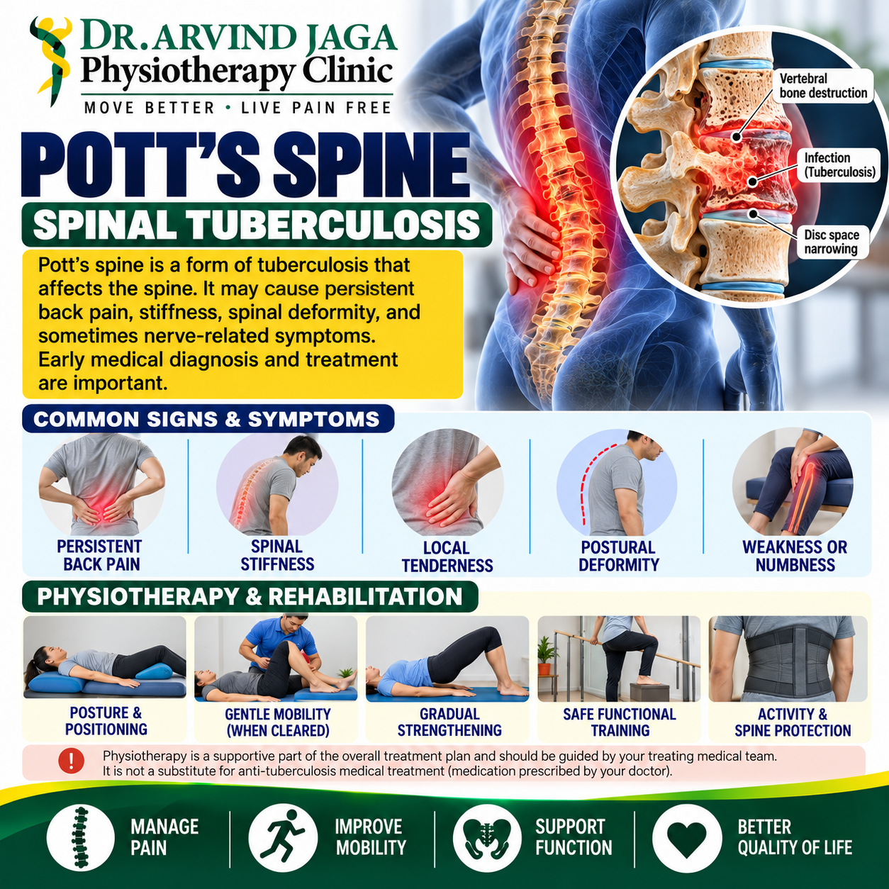 Understanding Pott's Spine, or spinal tuberculosis, is the f
