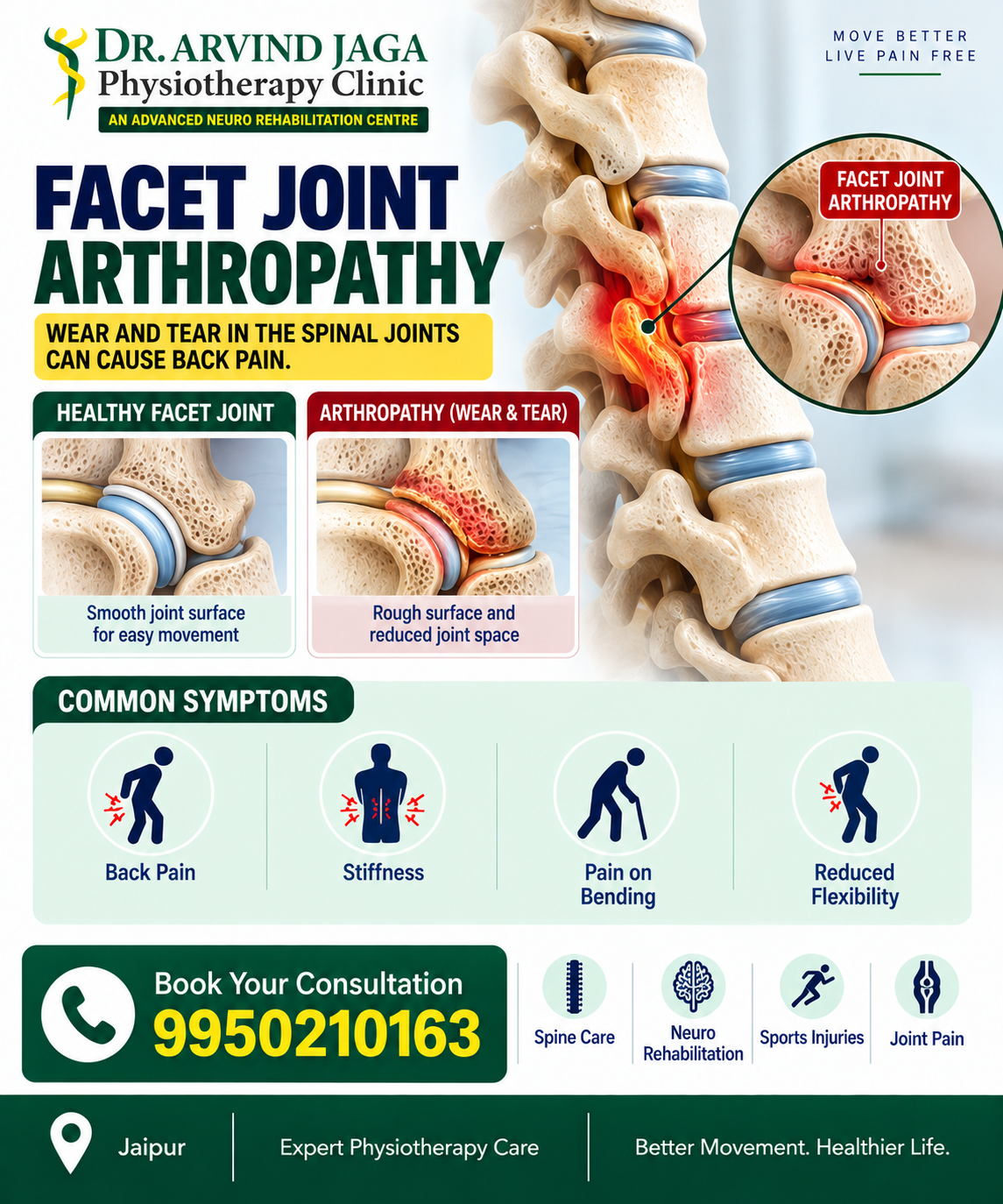 Experiencing persistent back pain, stiffness, or reduced fle