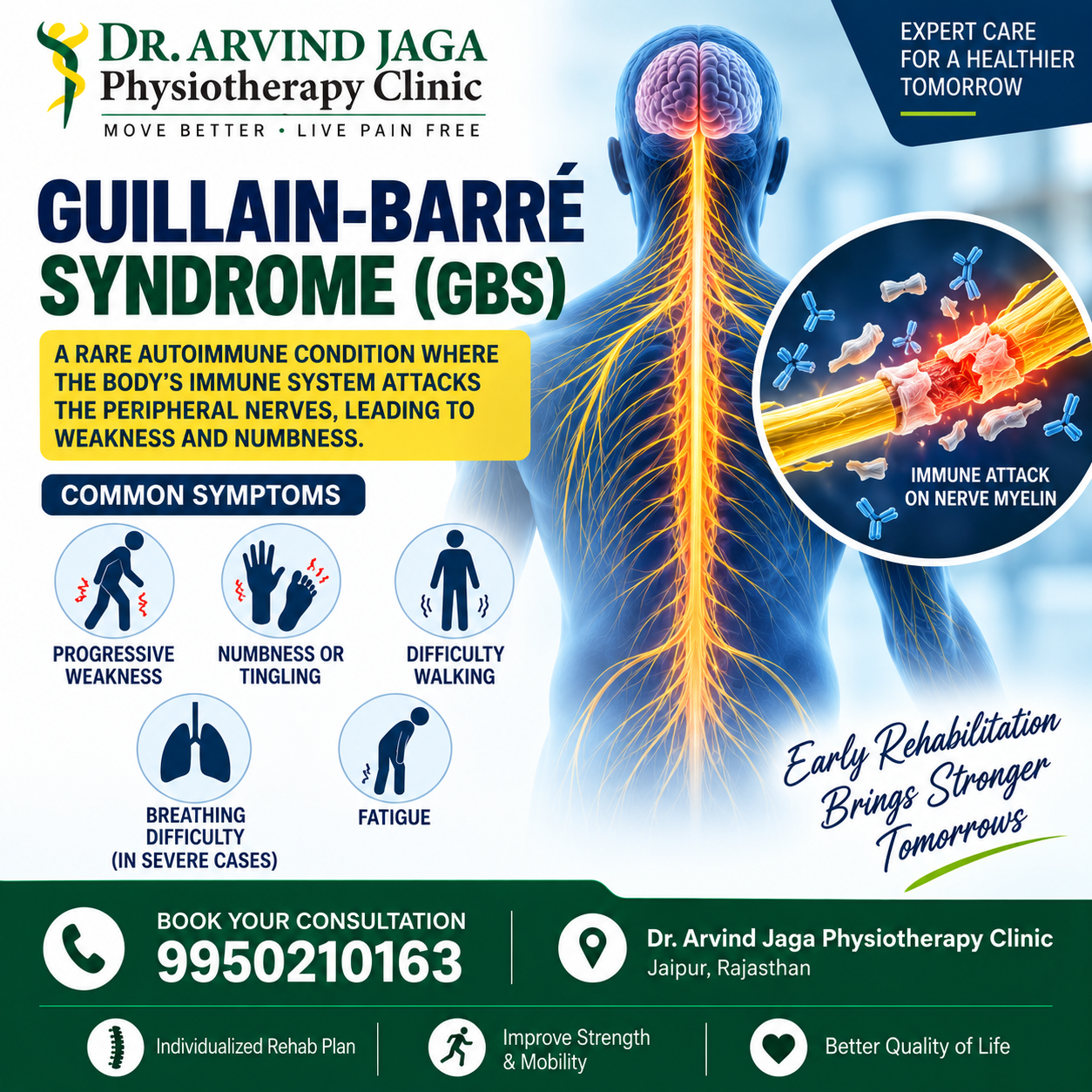 Understanding Guillain-Barré Syndrome (GBS) is the first ste