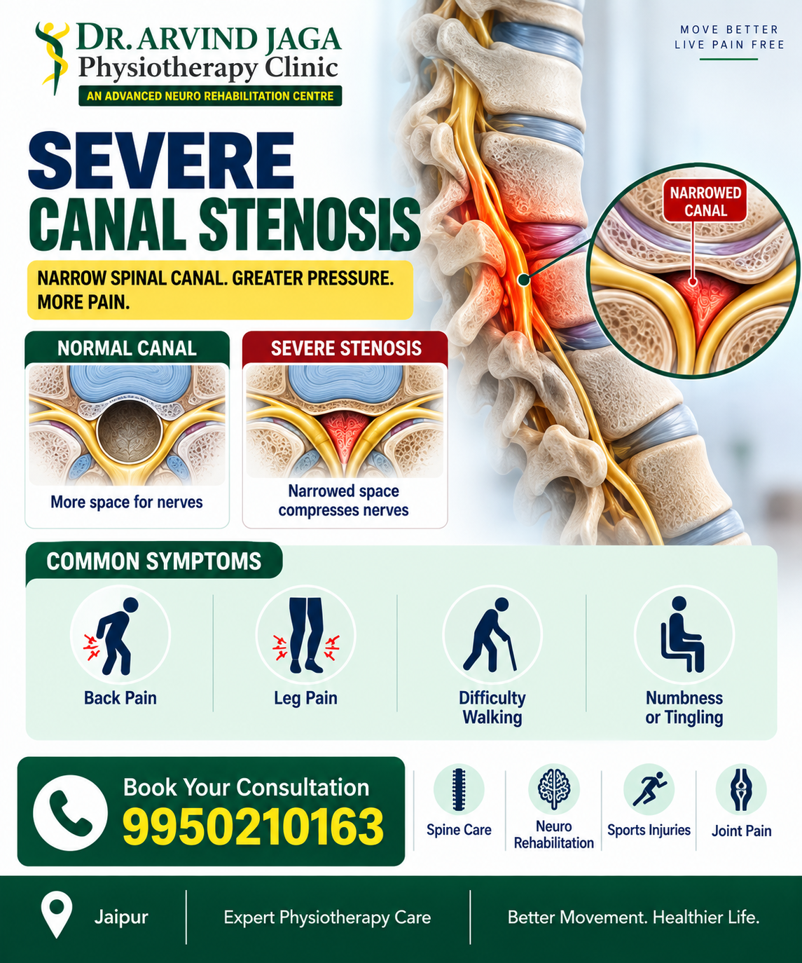 Experiencing discomfort from a narrowed spinal canal? Severe