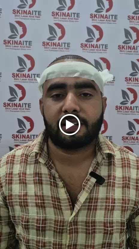 Skin care clinic — Skinaite Clinic in Jaipur (photo 14)