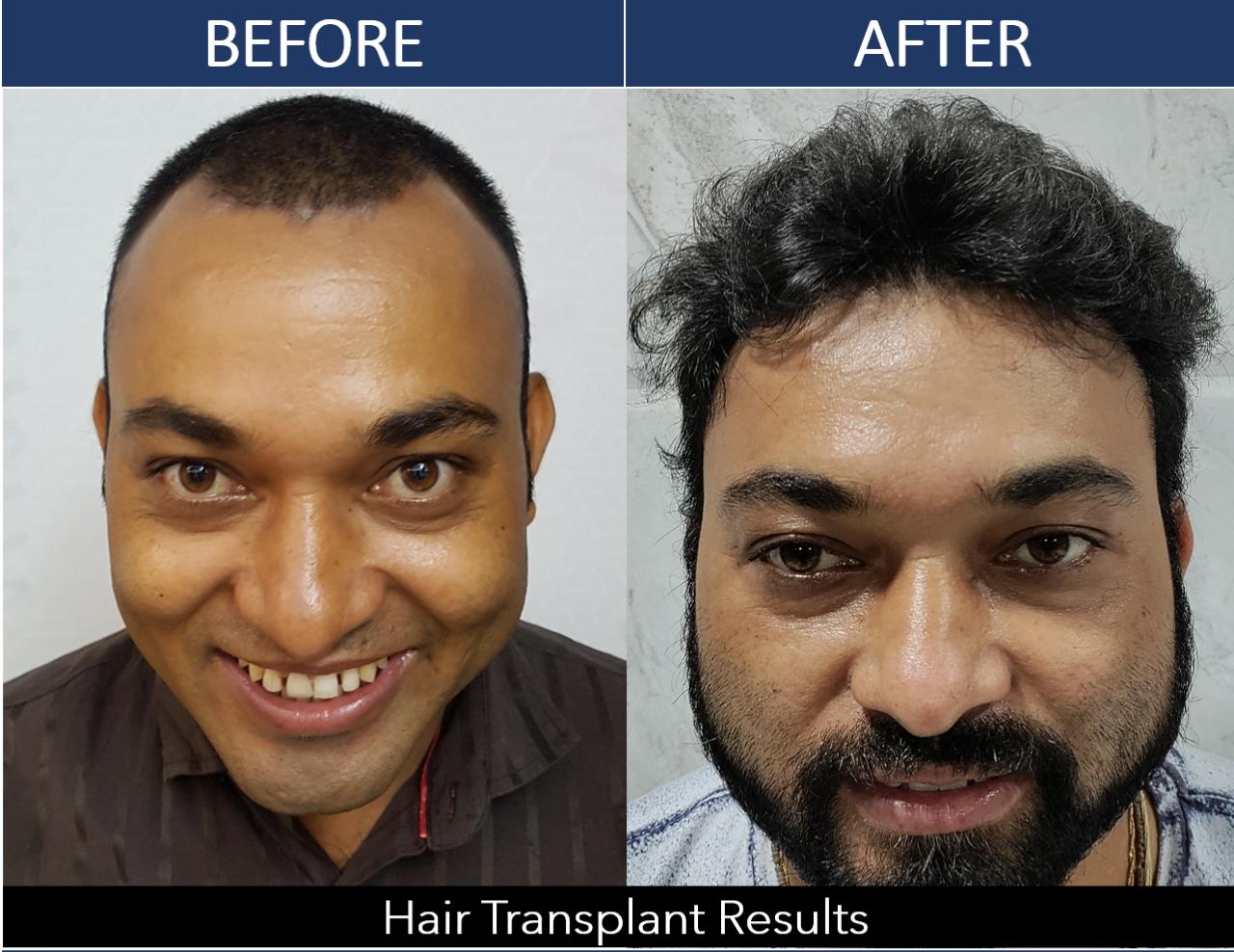 Skin care clinic — Skinaite Clinic in Jaipur (photo 23)