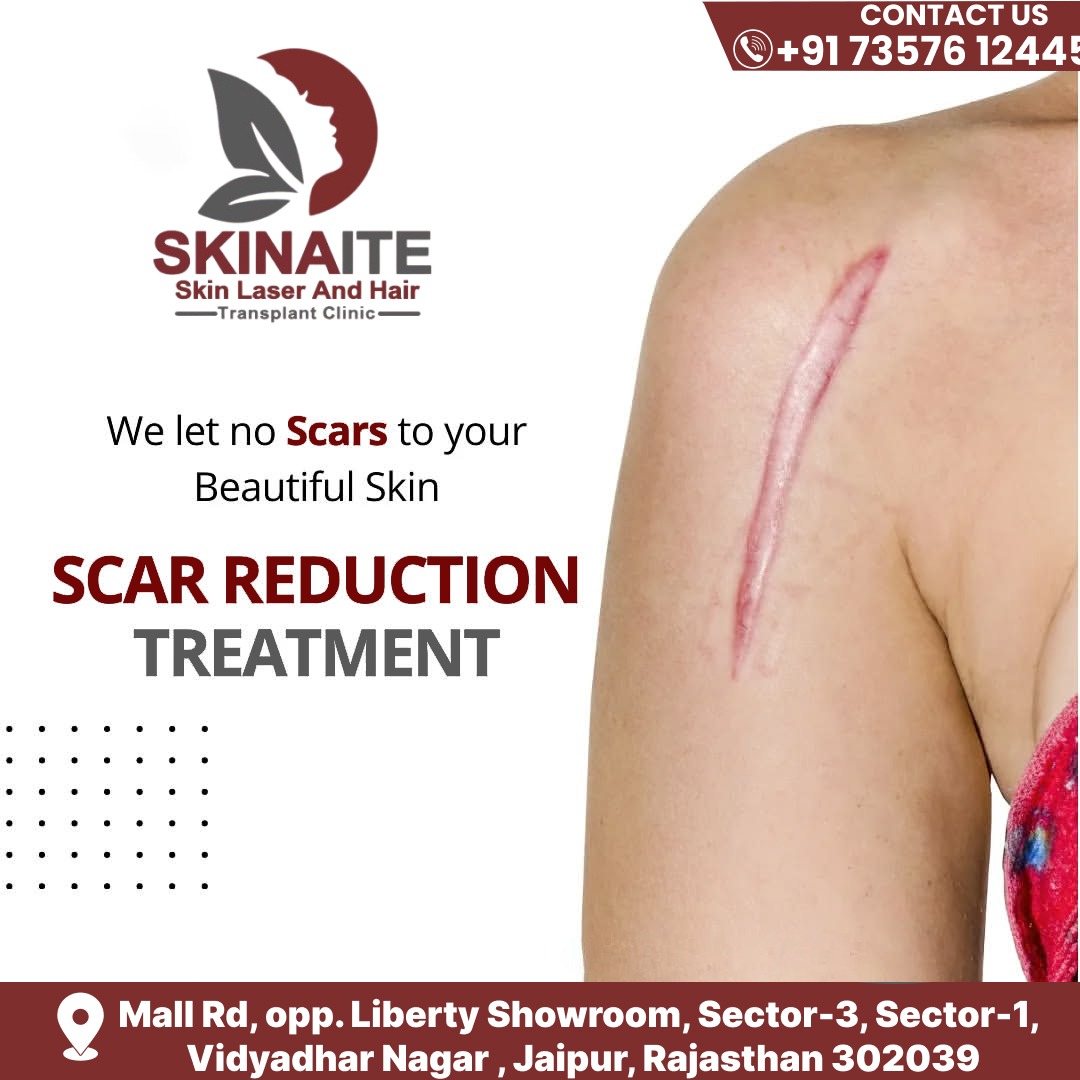 Skin care clinic — Skinaite Clinic in Jaipur (photo 7)