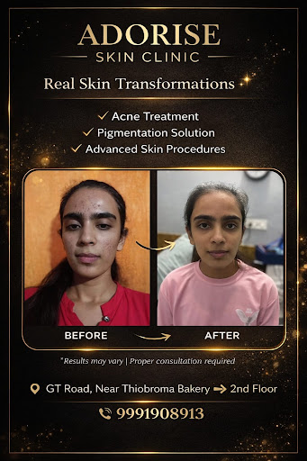 Skin care clinic — ADORISE SKIN AND HAIR CLINIC in Jaipur (photo 4)