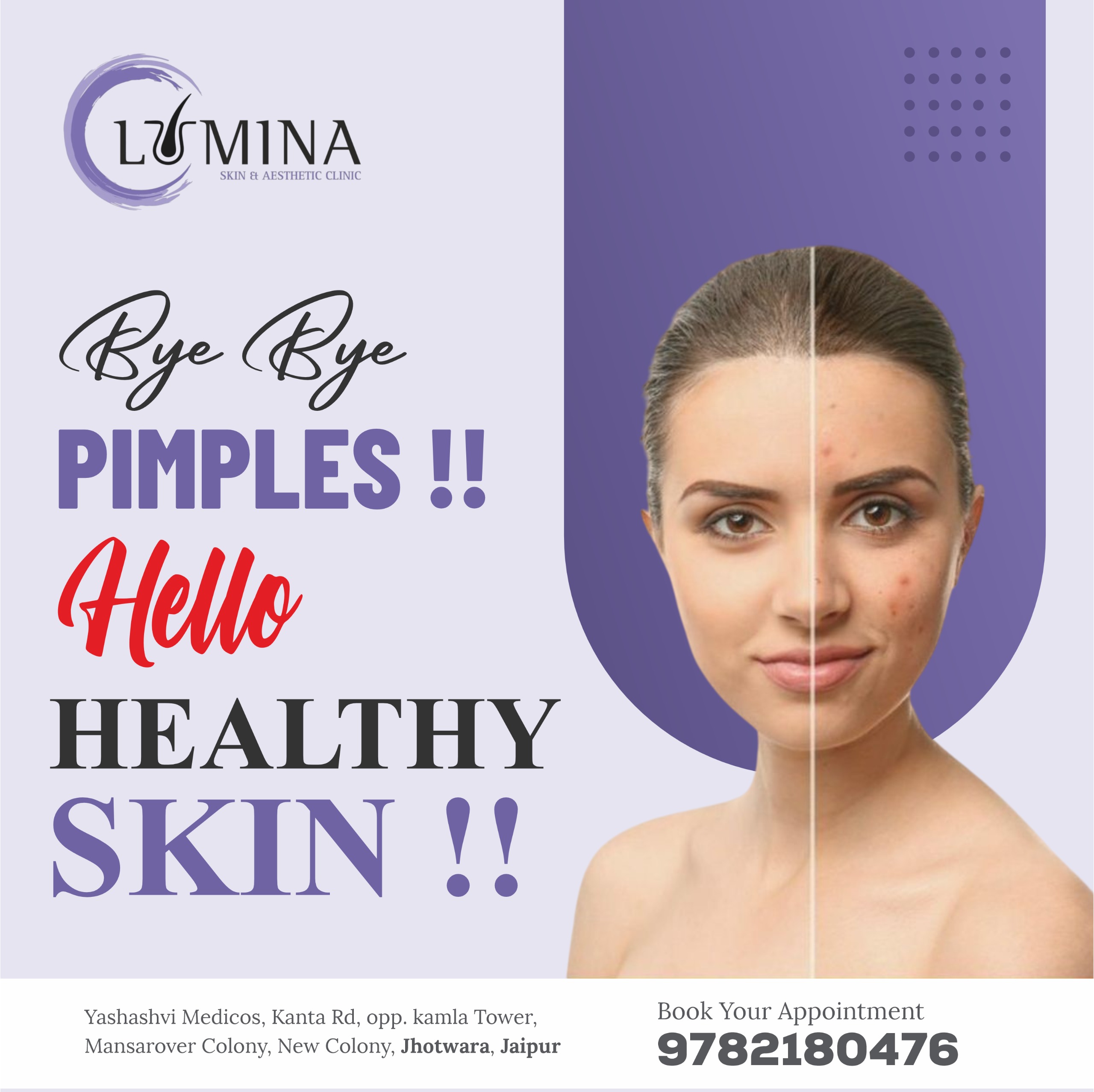 Dermatologist — Dr. Vishnu jangid-LUMINA in Jaipur (photo 9)