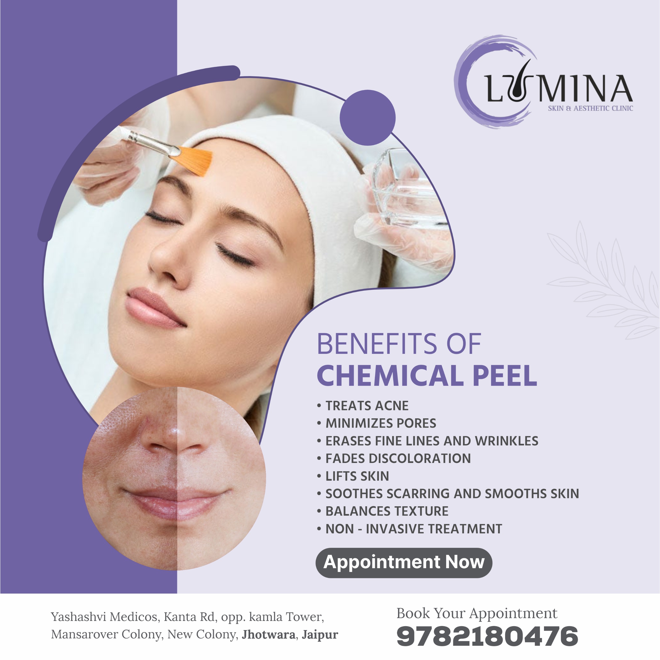 Dermatologist — Dr. Vishnu jangid-LUMINA in Jaipur (photo 8)