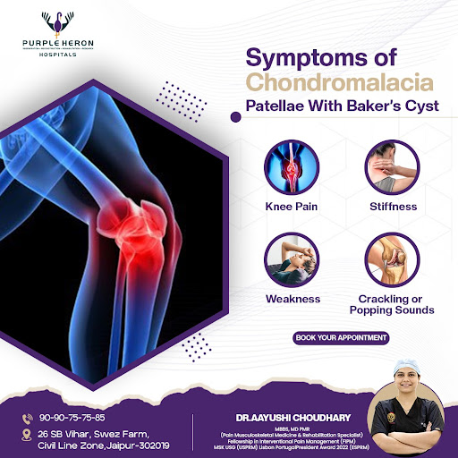Symptoms of Chondromalacia Patellae With Baker's Cyst  
Chon
