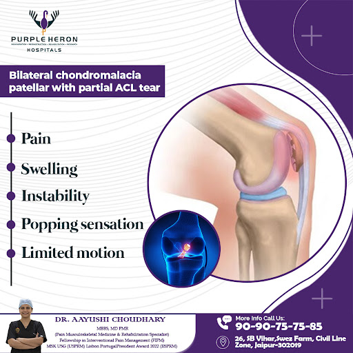 Bilateral chondromalacia patella with a partial ACL tear can lead to persistent 
