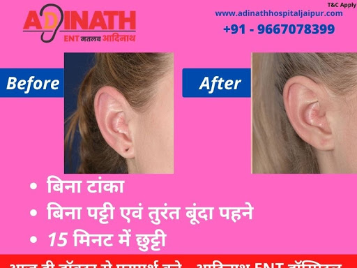 Ear Treatment in jaipur - Ear doctor in jaipur
Dr. lovelish 