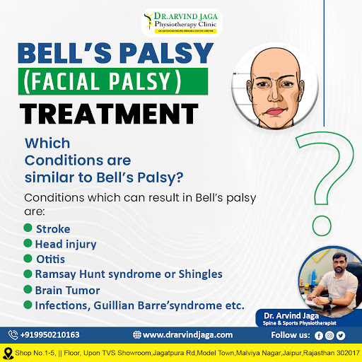 🌟 Rediscover Your Smile with Effective Facial Palsy Treatment by Dr. Arvind Jag