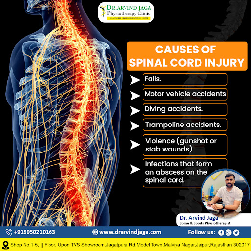 🌟 Unlock Relief with Specialized Spinal Cord Treatment by D