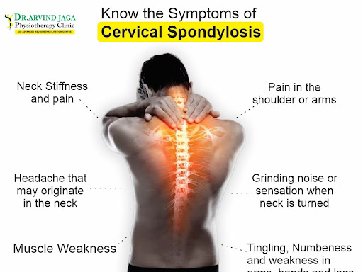 Curious about cervical spondylosis and its symptoms? Dr. Arv
