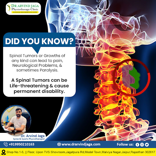 🌟 Did You Know? 🌟

Spinal tumors or growths of any kind can lead to pain, neur