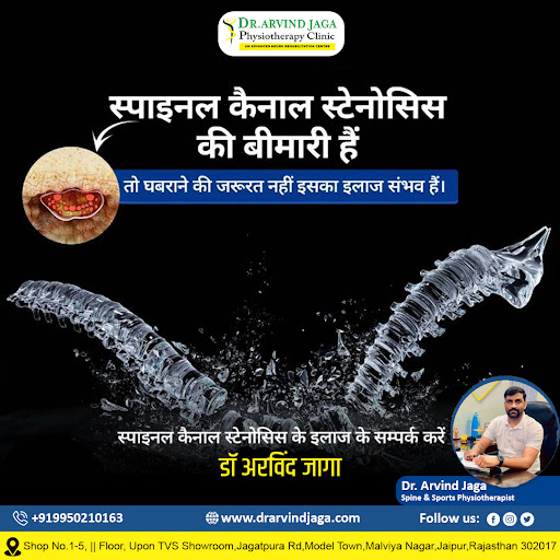 🌟 डॉ. अरविंद जागा के साथ स्पाइनल कैनाल स्टेनोसिस दर्द को अलविदा कहें! 🌟

स्पाइ