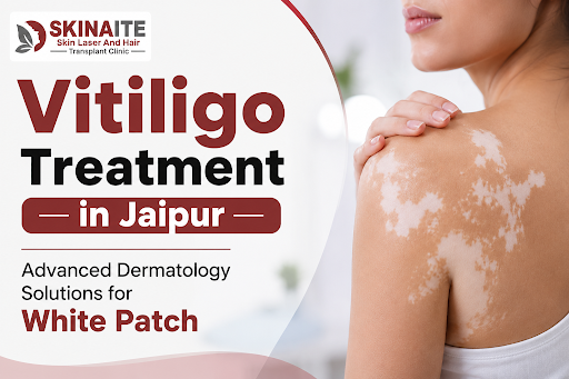 🤍 Are you struggling with Vitiligo or white spots and looki