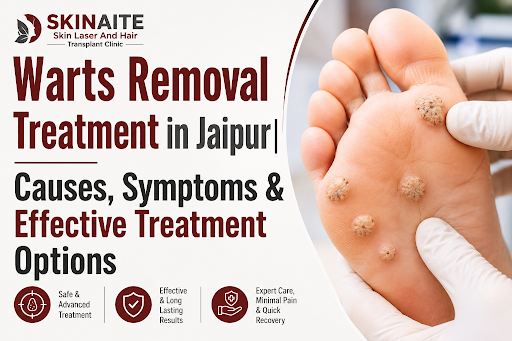 ✨ Say Goodbye to Warts with Advanced Warts Removal Treatment
