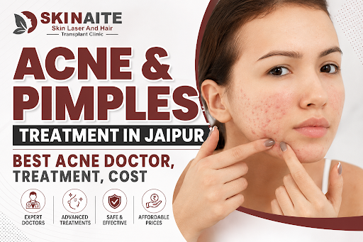 ✨ Tired of hiding your acne? It's time to enjoy clear, healt