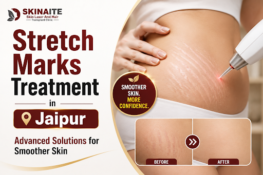 ✨ Bothered by Stretch Marks on Your Stomach, Thighs, Hips, o