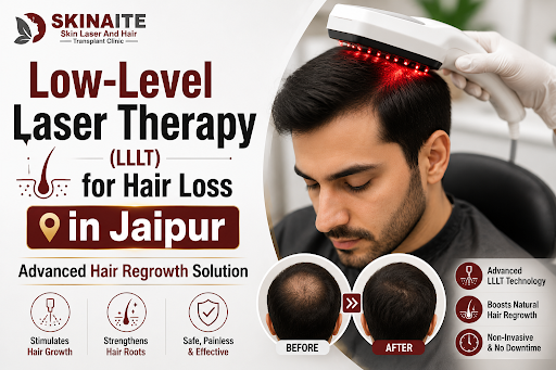 🔴 Looking for a Non-Surgical Solution for Hair Loss in Jaip