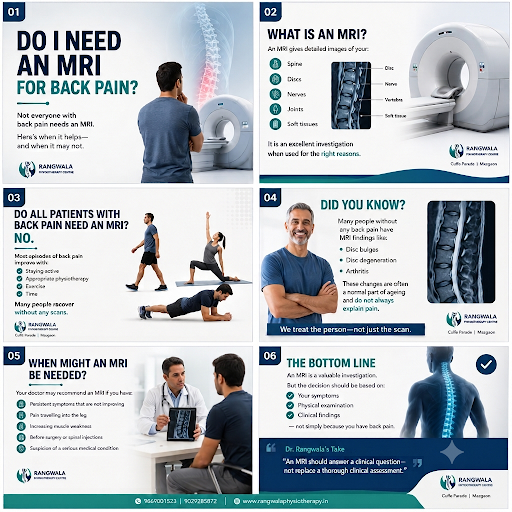 Do I Need an MRI for Back Pain?

One of the most common ques