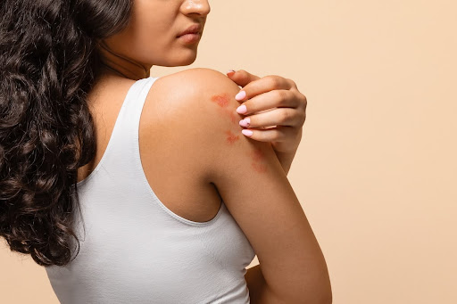 Kya aap skin allergy, red rashes, ya khujli ki samasya se pa