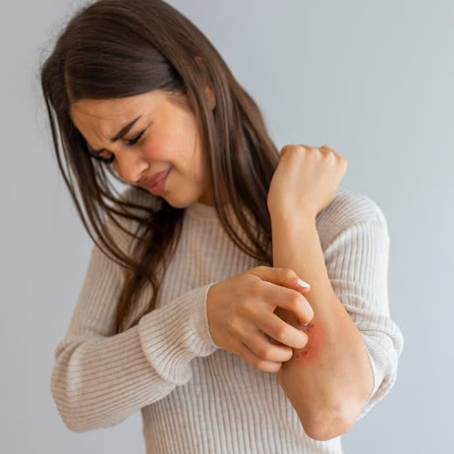 Skin allergy, khujli aur skin rash se pareshan hain? Advance