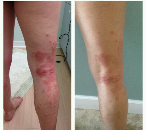 Improve your skin health with expert dermatology care in Jai