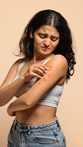 Dealing with persistent skin itching, rashes, or sudden alle