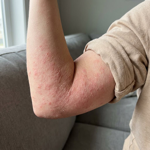 Don't ignore persistent skin rashes, dry patches, or irritat