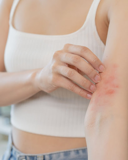 Don't let persistent skin irritation or sudden allergic reac