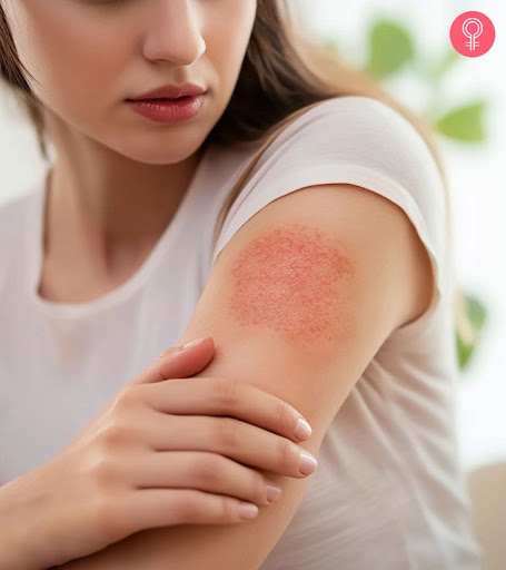 Redness, itching or irritated skin? Get expert care for skin