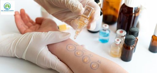 Skin Allergy Testing & Treatment in Jaipur