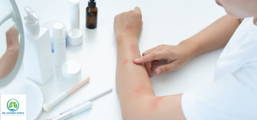 Skin Allergy Treatment in Jaipur – Expert Diagnosis & Care