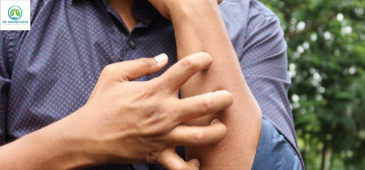 Seasonal Allergy Symptoms in Jaipur – Don’t Ignore Early Signs