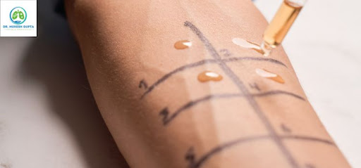 Allergy Test: Kab, Kyun aur Kaise?