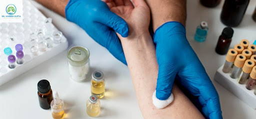 Skin Allergy Testing & Treatment in Jaipur
